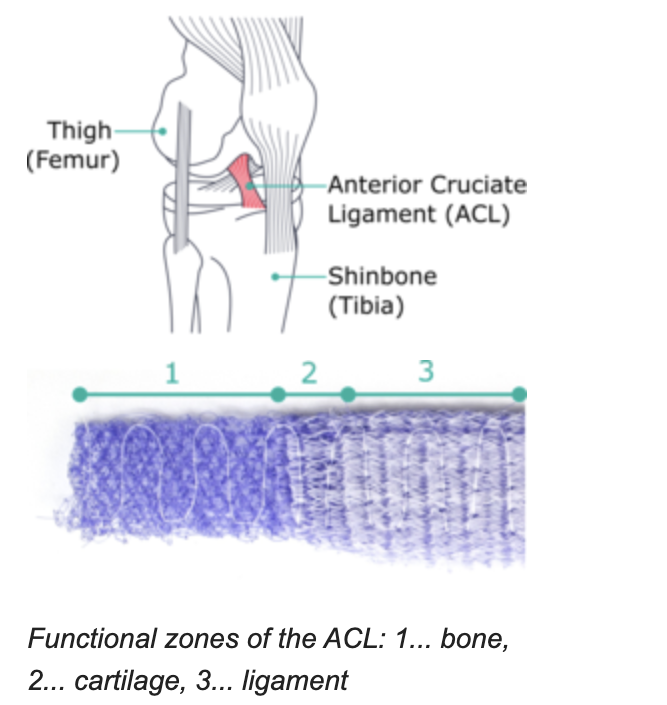Diagram of the knee showing the anterior cruciate ligament, and an embroidered scaffold divided into three functional zones